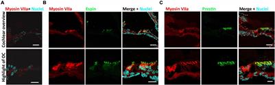 Hearing Recovery Induced by DNA Demethylation in a Chemically Deafened Adult Mouse Model